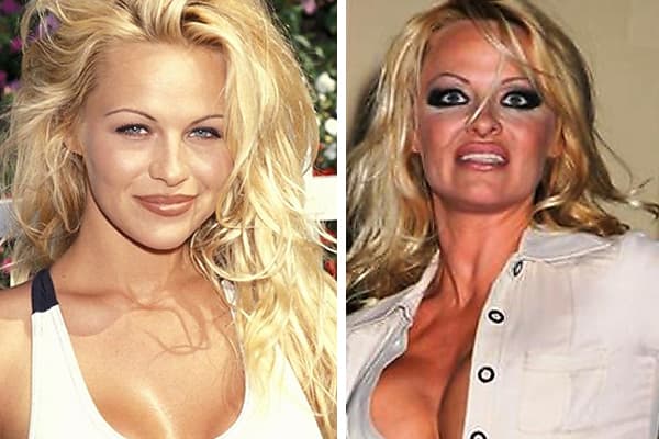 Pamela Anderson